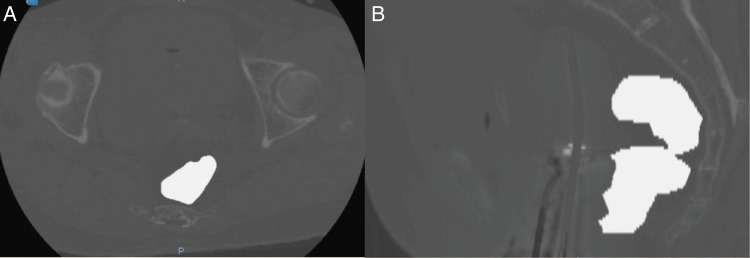 Fig. 3.