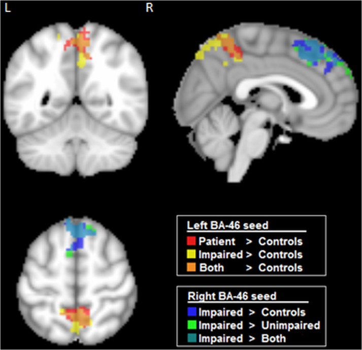 Fig 4