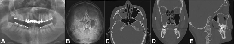 Fig. 8