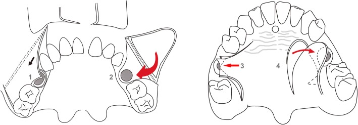 Fig. 11