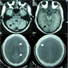 FIG 2