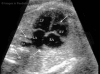 Fig 5