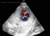 Fig. 14-15