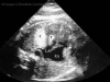 Fig. 12