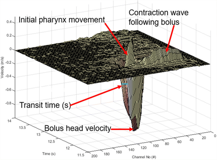Fig. 2