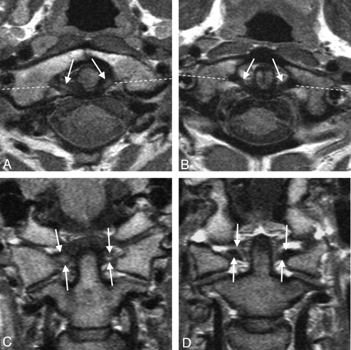 Fig 3.