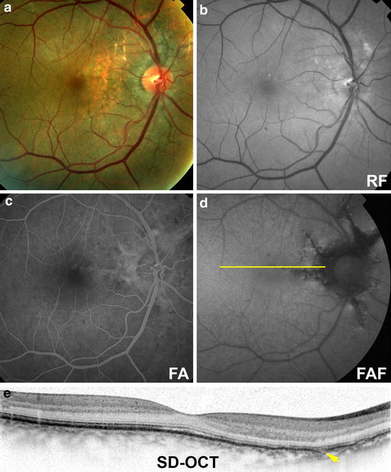 Fig. 1