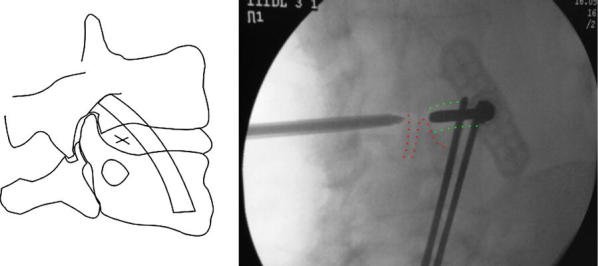 Fig. 2