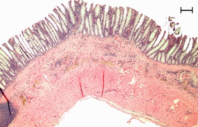 Figure 3e: