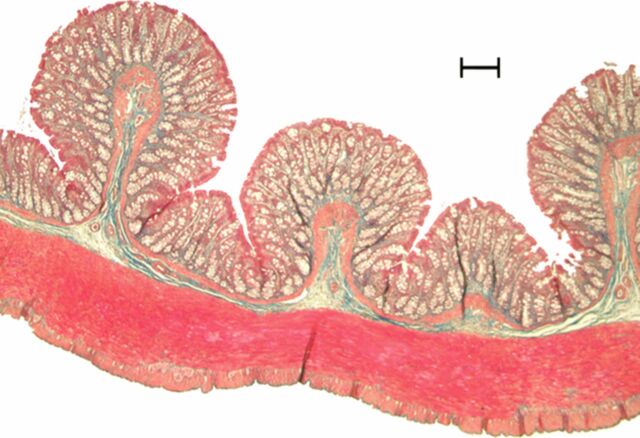 Figure 3b: