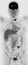 Figure 2b: