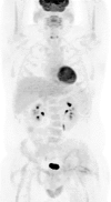Figure 1d: