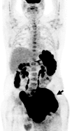 Figure 1a:
