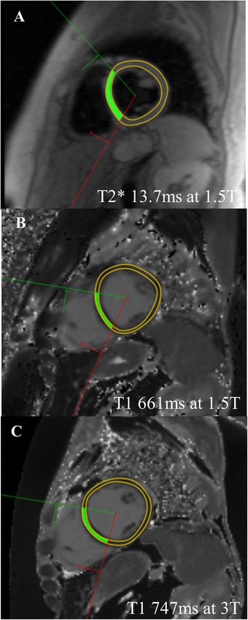 Fig. 1