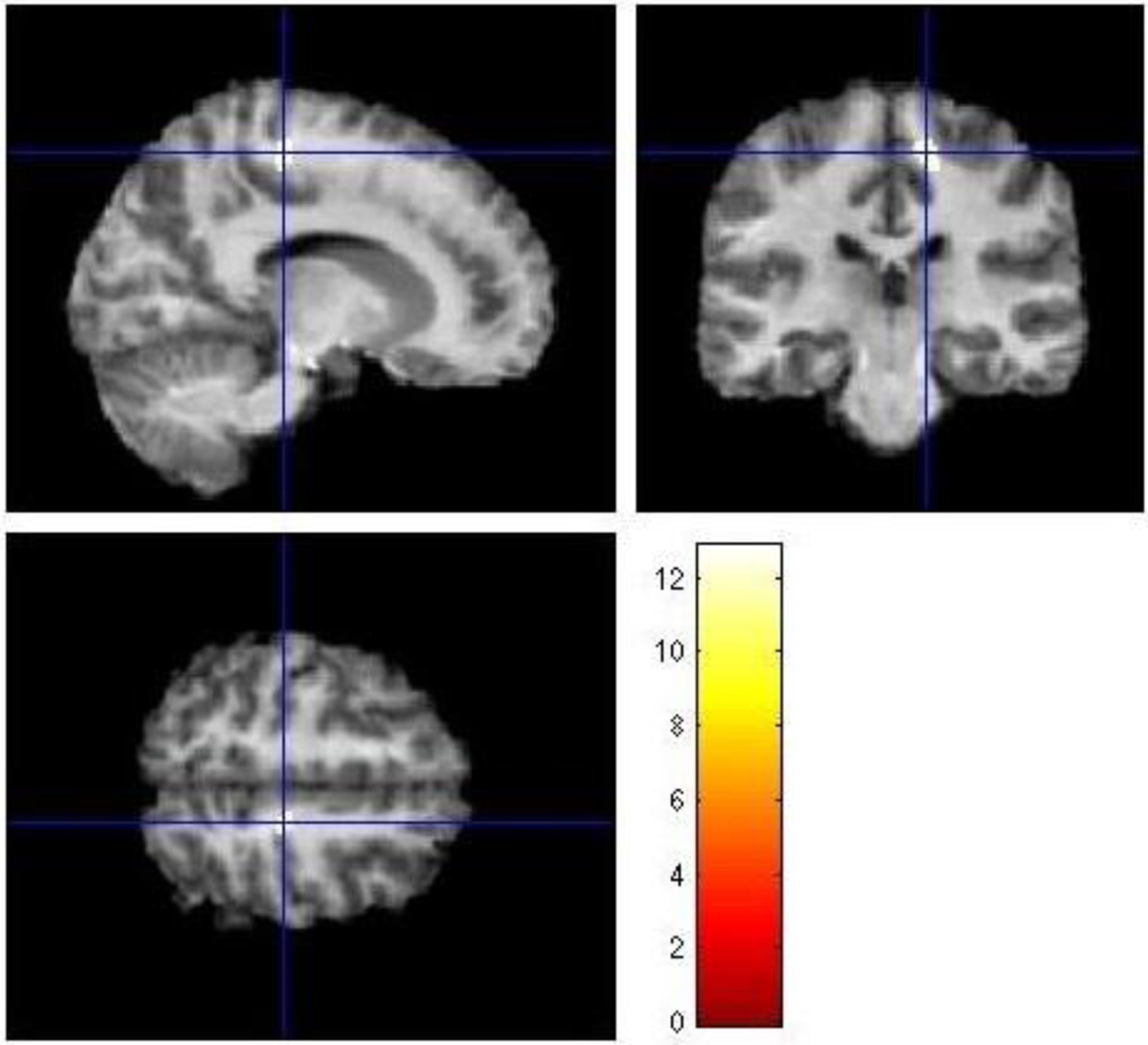 Figure 1: