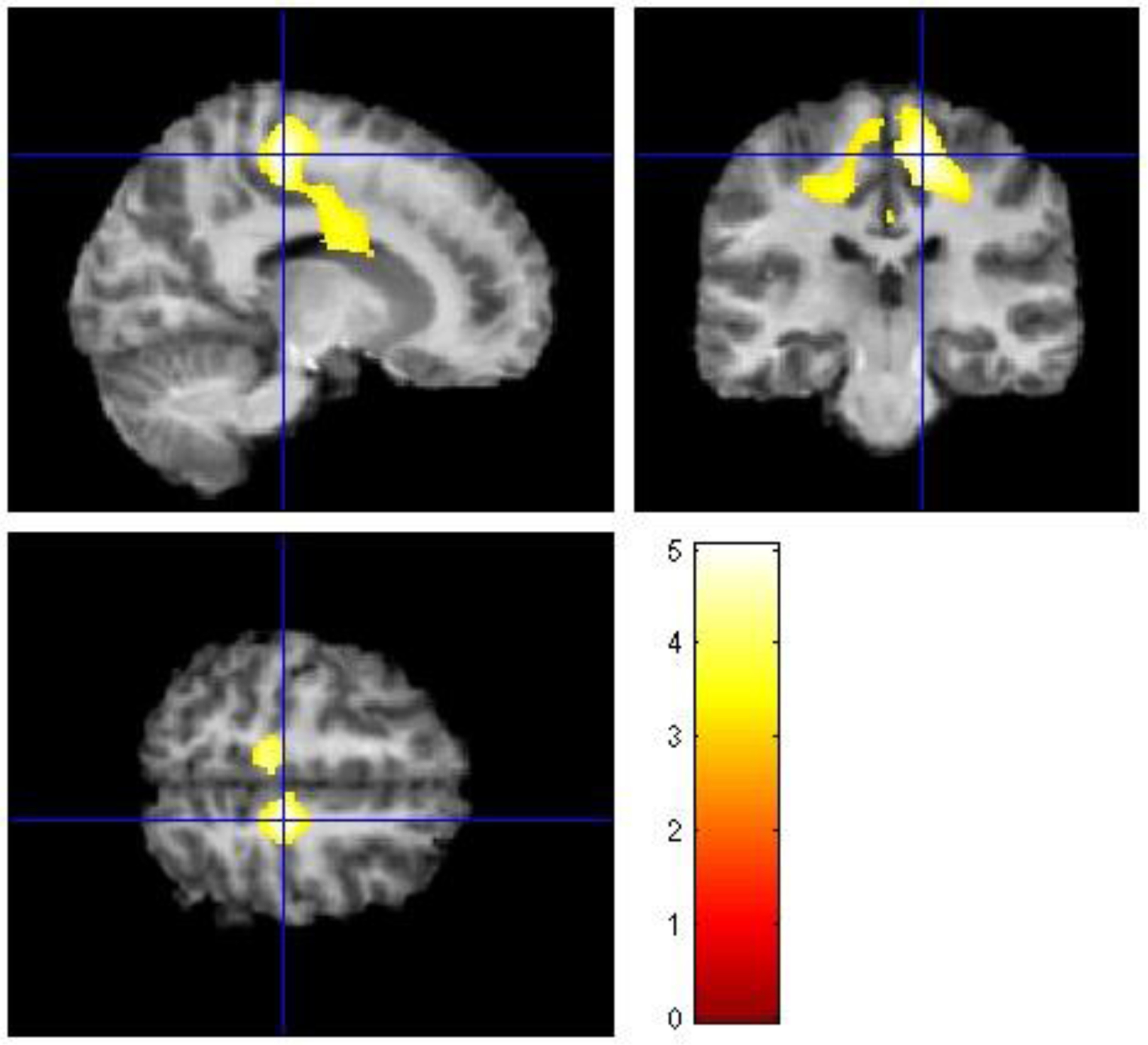 Figure 3: