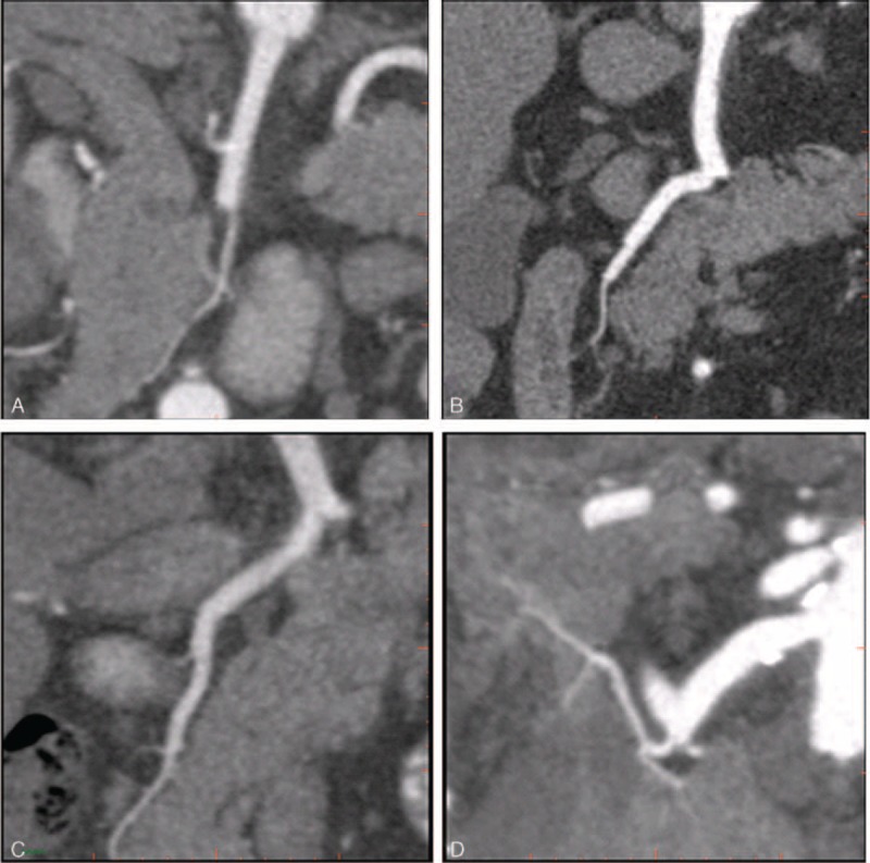 FIGURE 3