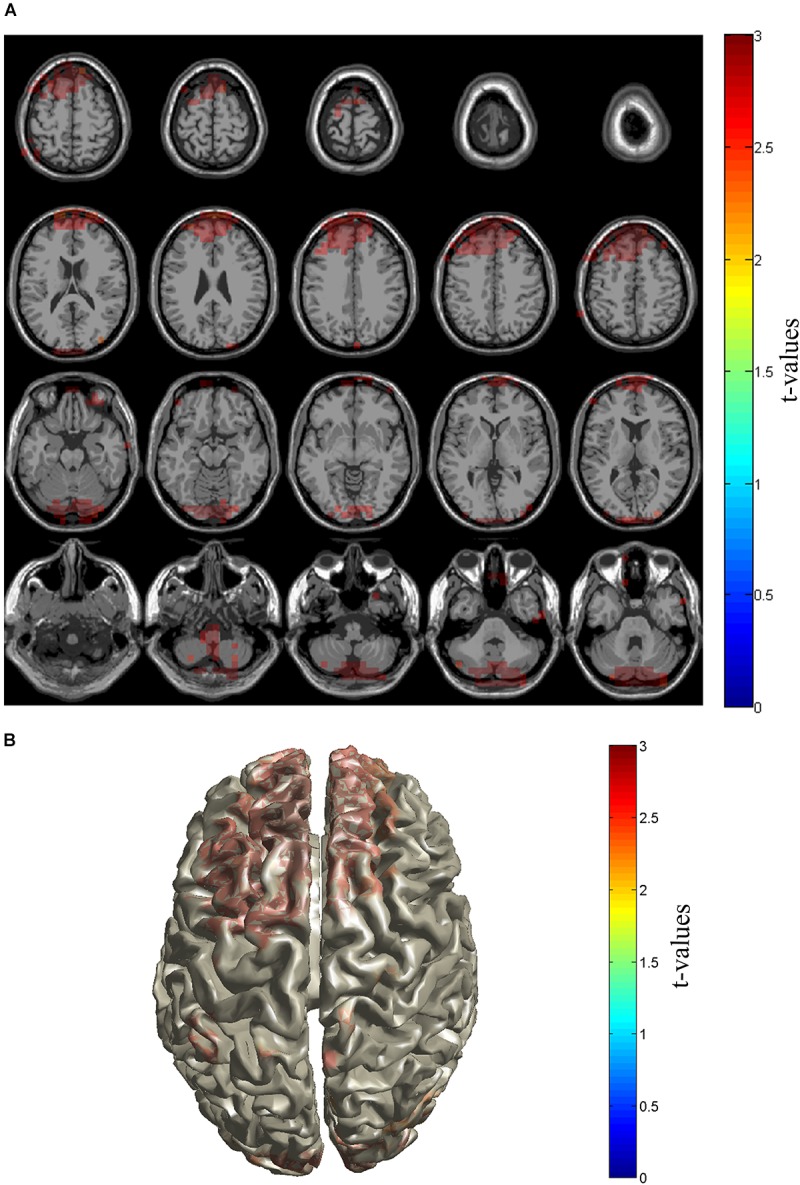 FIGURE 3