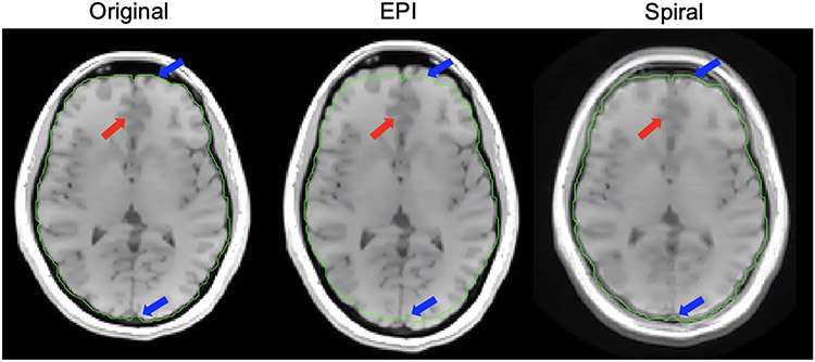 Figure 6: