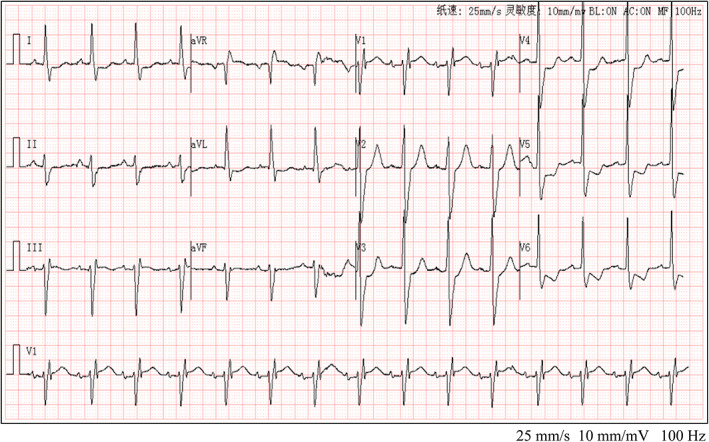 FIGURE 2