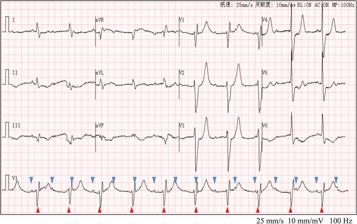 FIGURE 1