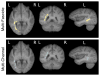 Fig. 13
