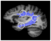 Fig. 11