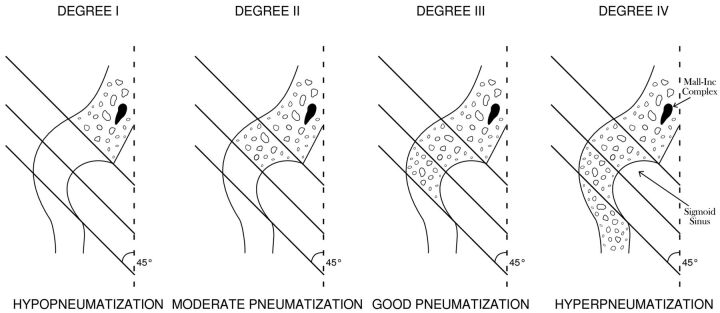 Fig 3.