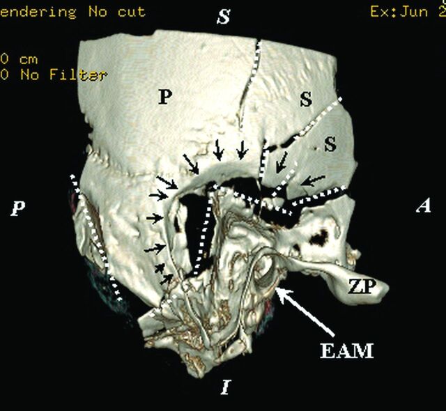 Fig 4.