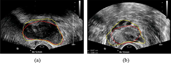 Fig. 9.