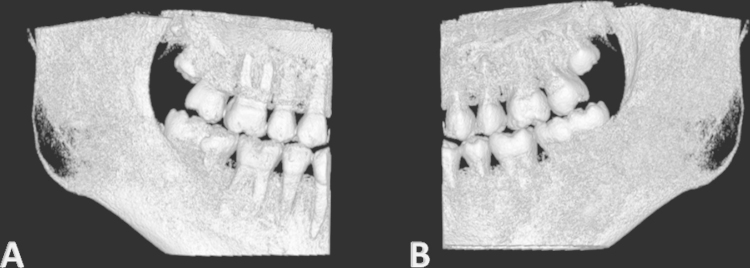 Fig. 9