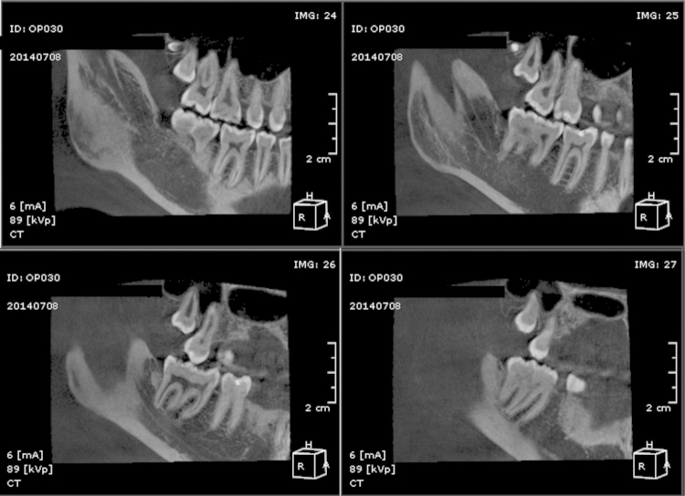 Fig. 6