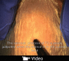 Video 1.