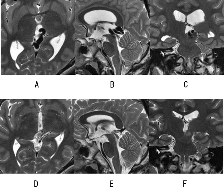 Fig 3