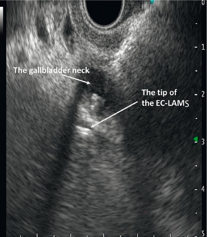 Fig. 1