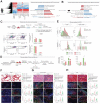 Figure 4. Metabolic cross-talk between cancer cells and stroma. A, Left, heatmap of the normalized expression of genes from TCGA data set (rows) classified as benign nevi, atypical nevi, vertical growth phase melanoma (VGP), and in situ melanoma compared with melanoma metastases of indicated tissues (Supplementary Table S3). Red indicates high expression; blue indicates low expression. Right: KEGG enrichment analysis of the genes upregulated and downregulated in metastatic melanoma. B, KEGG enrichment analysis if genes downregulated in primary melanomas of mice exercised pre and post melanoma cell injection compared with control mice (3). C, top, experimental design for the coculture of the melanoma cells and primary cells for mitochondrial activity (stained by TMRE) by FACS (as indicated). Bottom left, FACS analysis of the mitochondrial activity in GFP-labeled Ret-melanoma cells cocultured with primary lung cells of control and active mice; TMRE expression is indicative of active mitochondria. Bottom right, calculation of TMRE+ cells in primary lung cells (top) melanoma (bottom) based on the FACS analysis. Error bars represent ± SEM (n = 6 animals in each group). *, P < 0.05. D, Schematic representation of the glucose uptake assay. E, Top and middle, FACS analysis of the uptake of 2-NBDG by melanoma (mCherry+) and stromal (mCherry−) cells originating from the lungs and lymph nodes. Bottom, intensity of the signal from 2-NBDG in stroma and melanoma from lungs and lymph of control and active mice. F and G, Left: Hematoxylin and eosin staining (20× magnification) and immunofluorescence analysis (40× magnification) of S100-Beta (green) and GLUT1, ALDOA, or COMPLEX I (red) in (F) lungs, (G) lymph nodes, and (H) livers. DAPI-stained nuclei appear in blue. White-dashed lines indicate tumor (T)–stroma (S) boundaries. Right, quantification of the red and green mean fluorescence intensities in the tumor and stroma normalized to DAPI mean fluorescence intensity using ImageJ. t test statistical comparison is represented: *, (black) indicates a t-test GLUT1, ALDOA, or COMPLEX I (red) comparison of the control and active animals in stroma or tumor regions; + indicates a t-test GLUT1 (red), ALDOA (red), COMPLEX I (red) of S100-beta (green) comparison of the stroma and tumor regions of the control animals; λ indicates a t test GLUT1 (red), ALDOA (red), COMPLEX I (red), or S100- Beta (green) comparison of the stroma and tumor regions of active animals. Error bars represent ± SEM (n > 15 fields from each area (stroma or tumor for each target) in at least three images). + or * or λ, P < 0.05; ++ or ** or λλ, P < 0.001; +++ or *** or λλλ, P < 0.001.