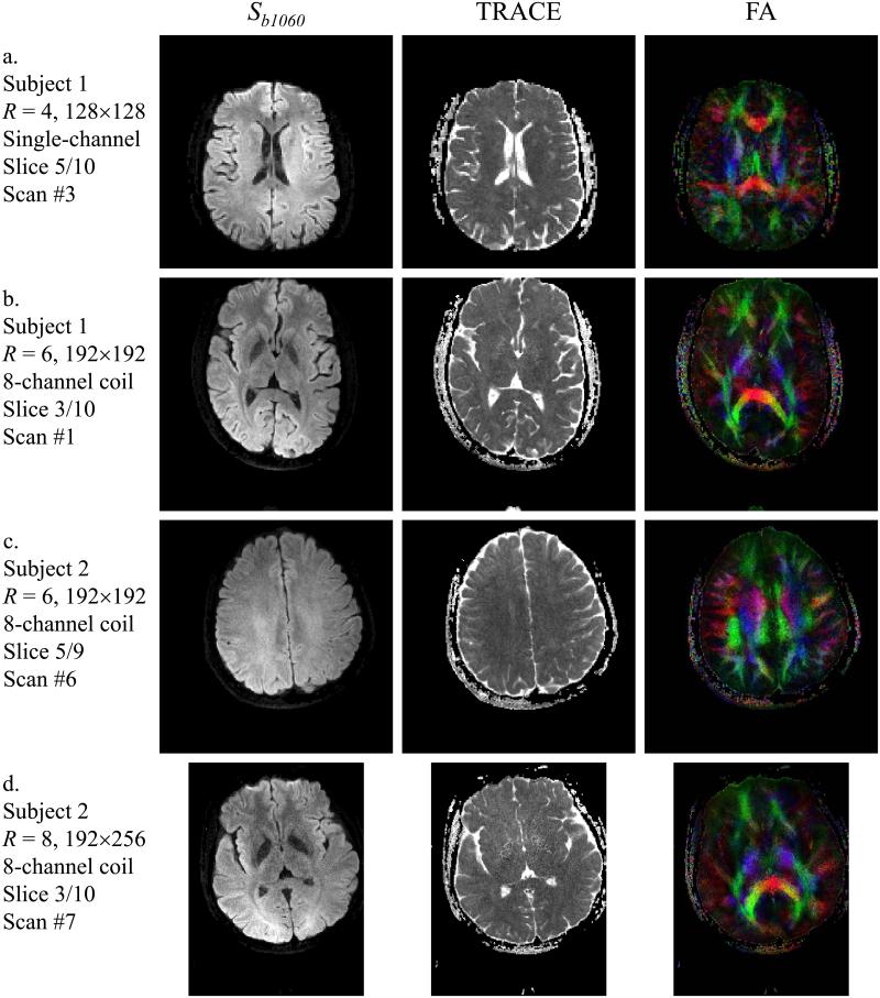 Fig. 12