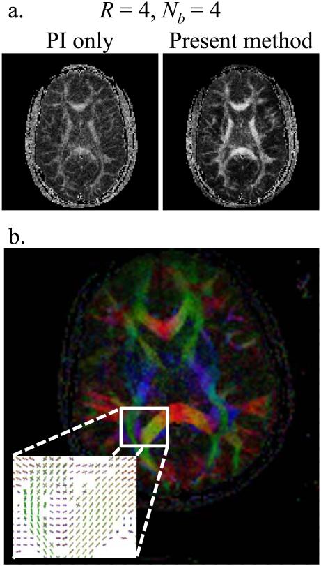 Fig. 14