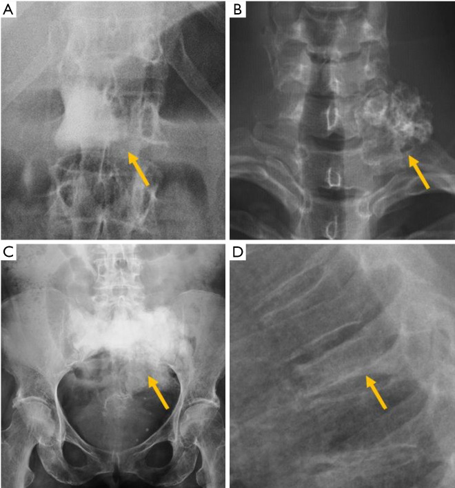 Figure 30