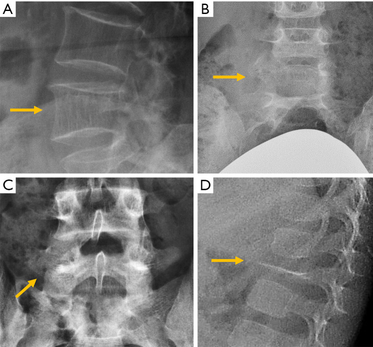 Figure 29