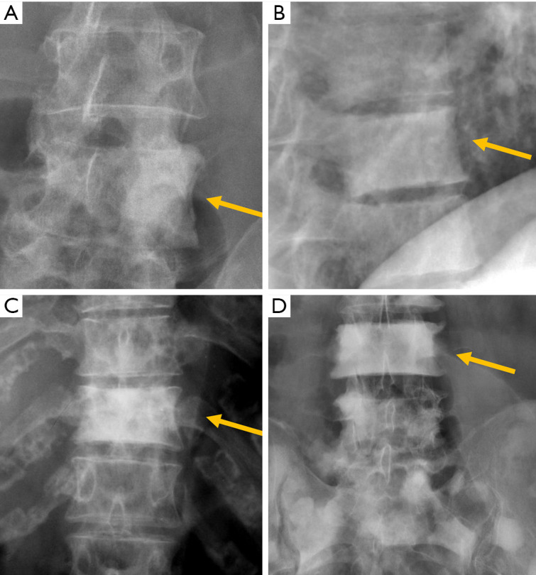 Figure 28