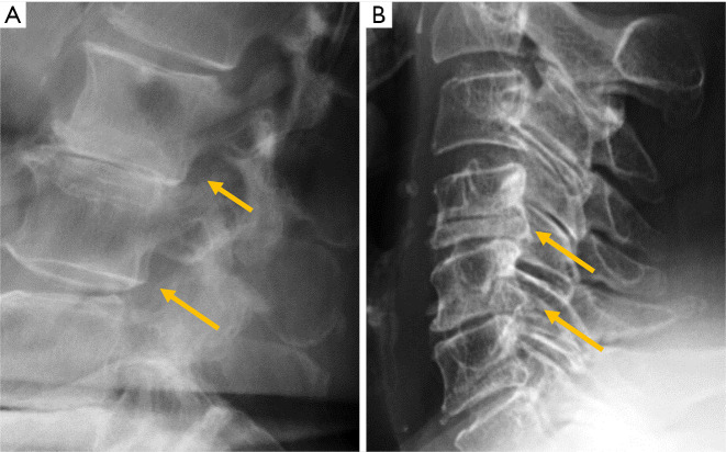 Figure 19