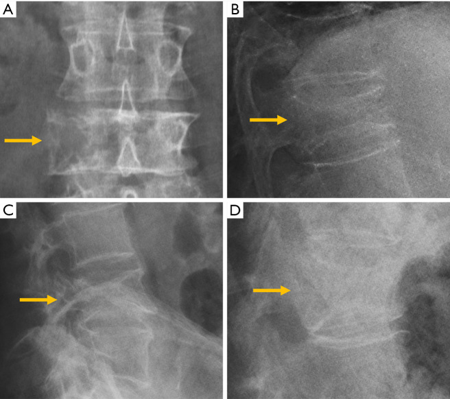 Figure 31