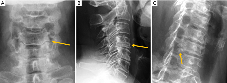 Figure 14