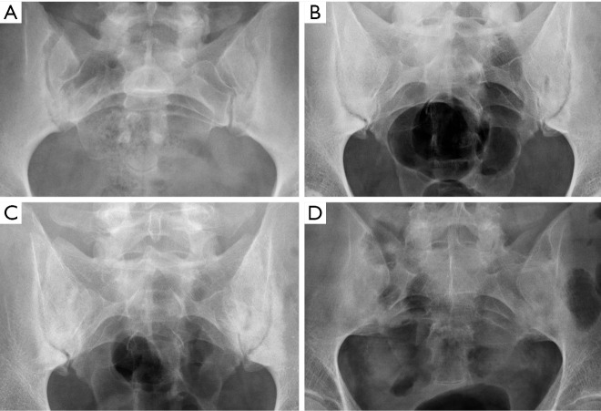 Figure 24