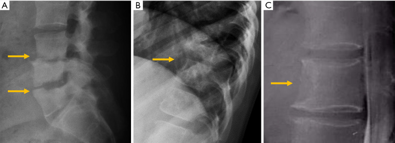 Figure 26