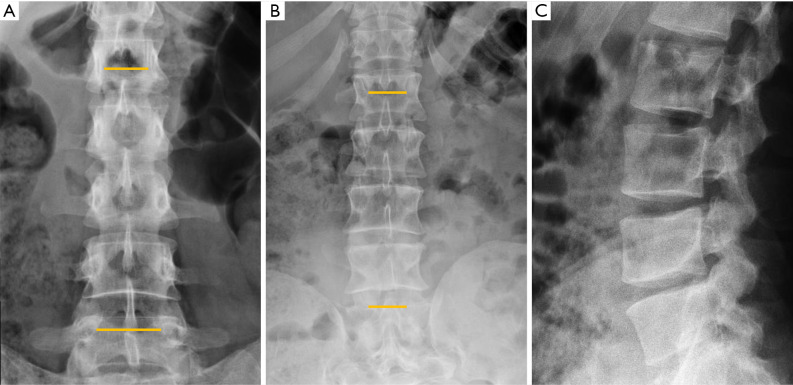 Figure 15