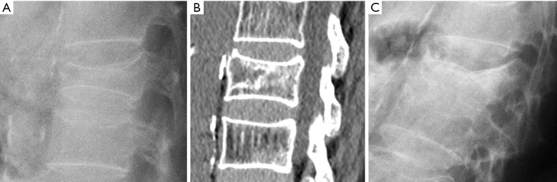 Figure 12