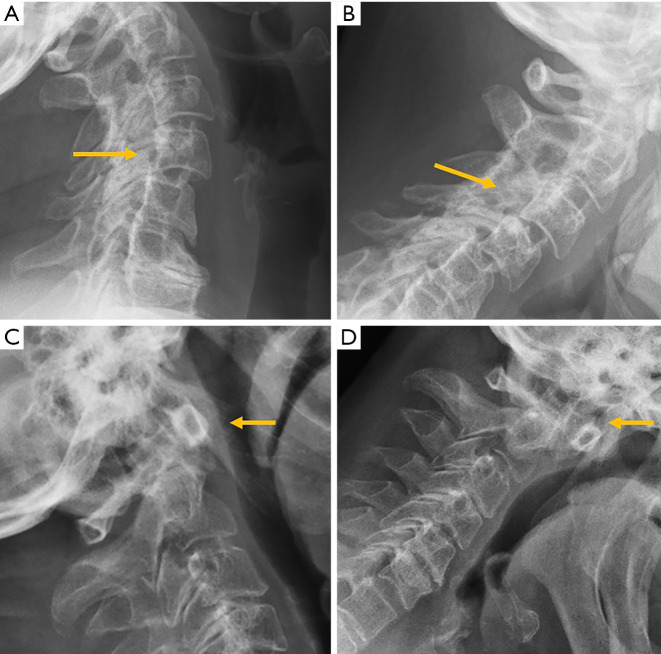 Figure 17