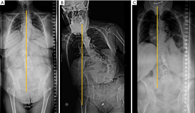 Figure 23